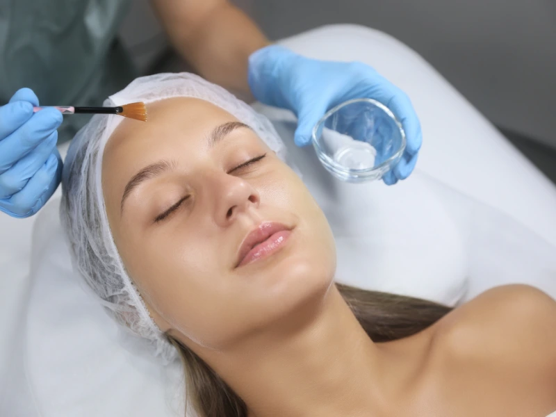 chemical peel benefits