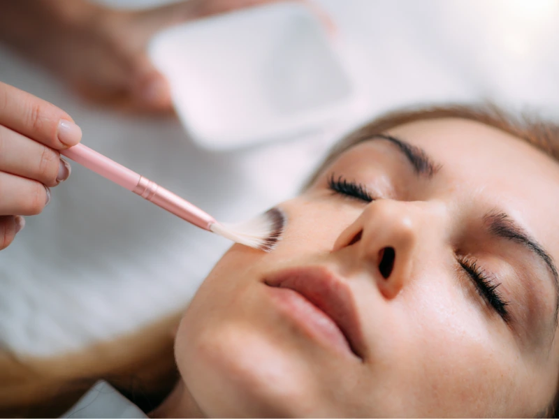 what is dermatologist chemical peel