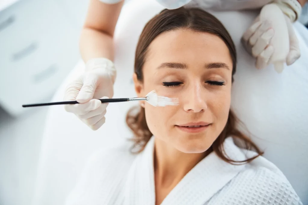 types of chemical peels