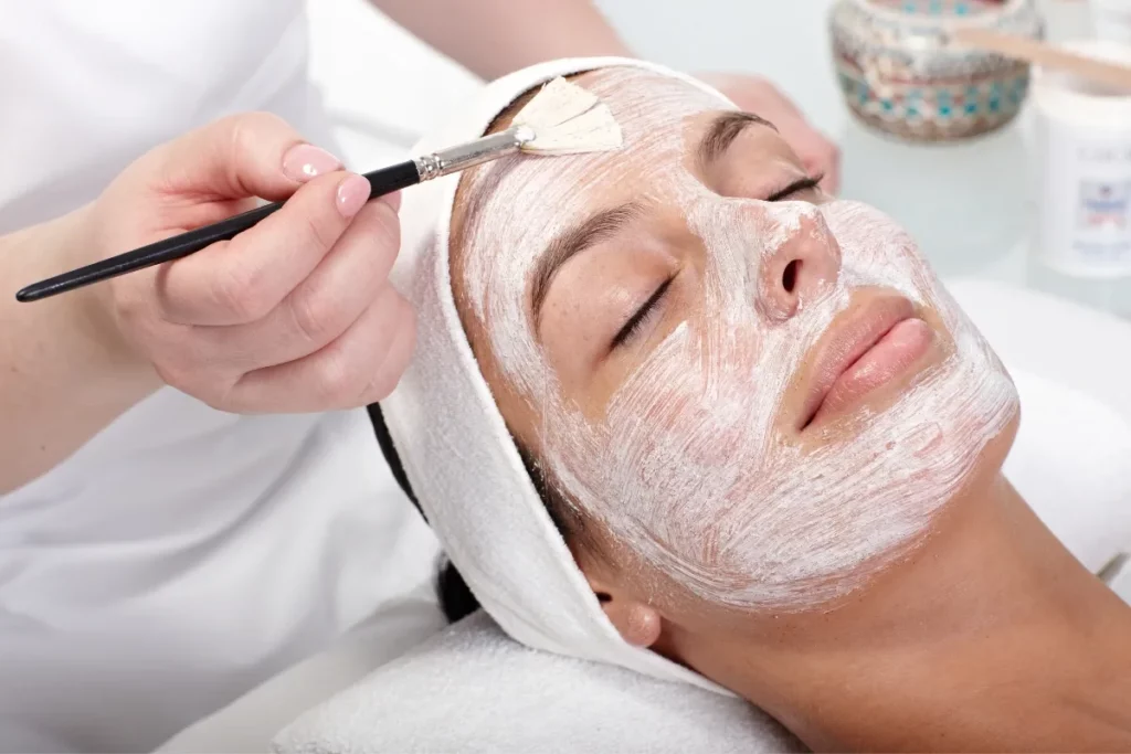 VI Peel for Melasma