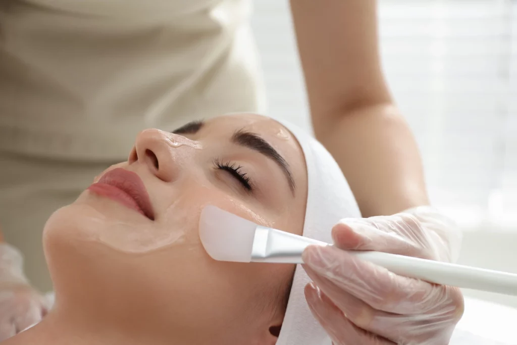 VI Peel in lake forest